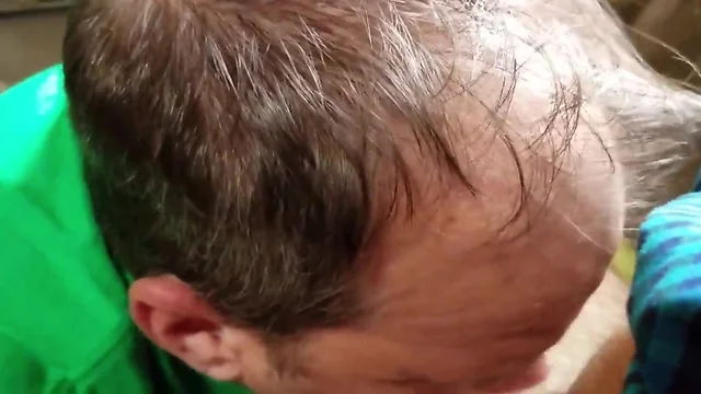 Crummy cheek and lips