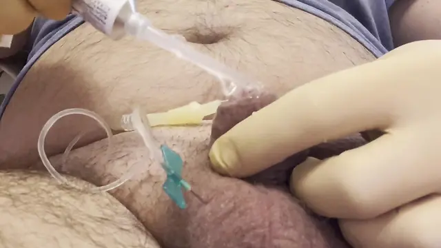 Inserting a large catheter into a small chubby cock with big balls.