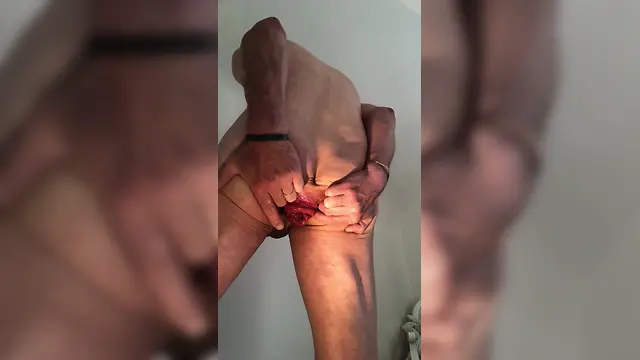 Introducing my anal prolapse: a how-to guide