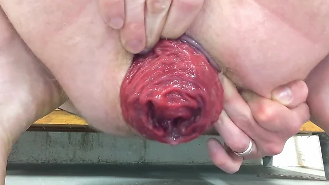Extreme anal fisting: prolapsed holes and massive dildos - nr. 6 amateur ff action! tags: anal, fisting